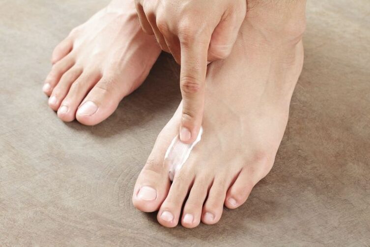 Application de la crème antifongique à la peau du pied