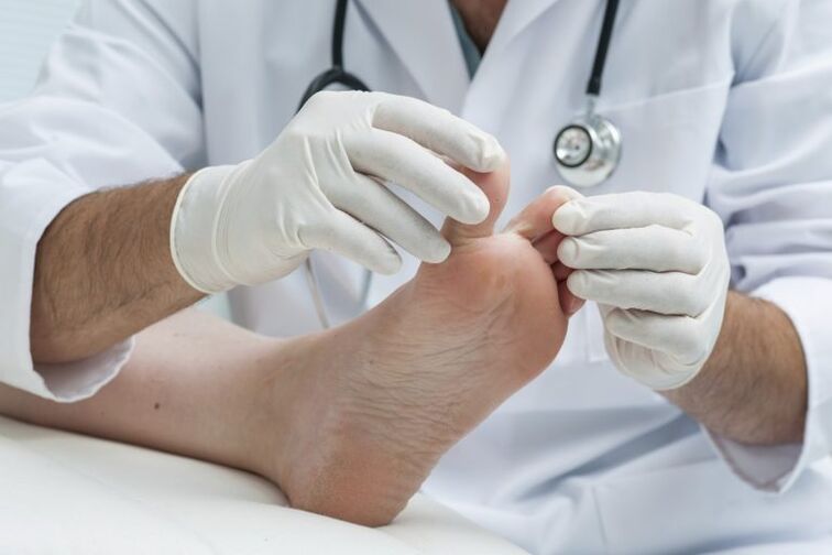 L'examen du médecin par la présence de la mycose