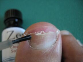 Application de vernis
