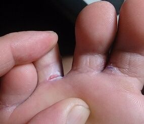 causes de la maladie
