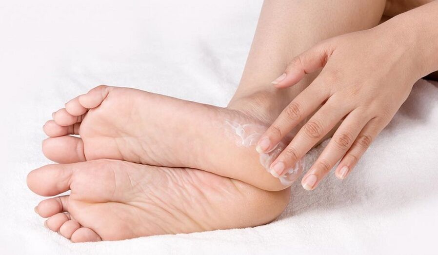 traitement des champignons des pieds avec une pommade