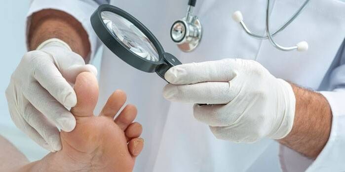 le médecin examine les pieds à la recherche de champignons entre les orteils