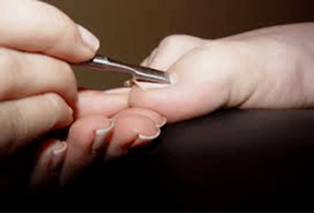 traitement des mycoses des ongles